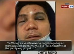 Doctor testifies that Vhong Navarro was seriously injured in Jan..